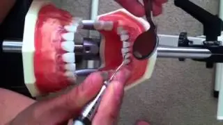 DH101 video