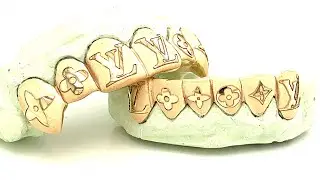6 Top 6 Bottom Laser Diamond Dusted Louis Vuitton Grillz Set by Seattle Gold Grills