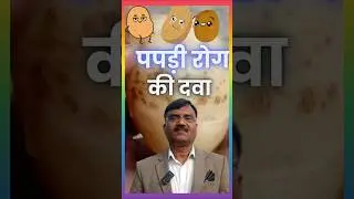 इसे लगाते ही पपड़ी रोग गायब #shorts #trending #ytshorts