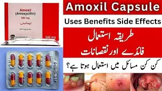 Amoxil capsule uses in urdu.|Amoxil 250mg capsule & Amoxil 500mg capsule use in urdu.