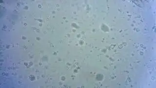 Is this Candida A.