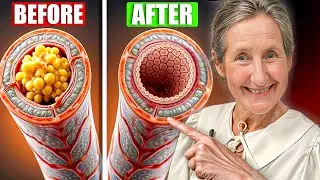 THIS Unclogs Arteries Instantly in Seniors &ndash; Big Pharma BANNED This Secret | Barbara O&rsquo;Neill