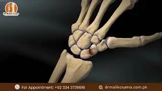 ✨ Scaphoid Screw Compression ✨