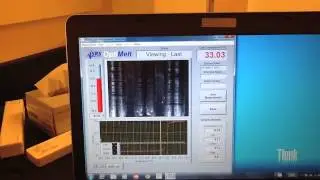 PNIPAM Analysis