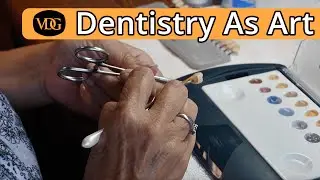 The Art Of Dentistry: Crown Glazing Tooth Restoration