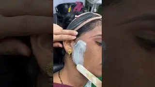 facial hair removal 🔥🔥#hairremoval #wax #waxing #facewax #facewaxing #viral #video