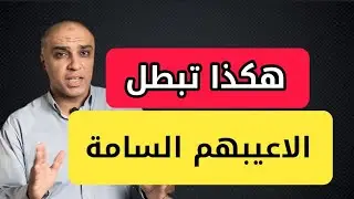 أقوي طريقه تجعل الشخص  السام يفقد صوابه امامك و يقف عند حده| اتعلم أصول اللعبة