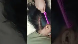 Soothing Scalp Checking Video To Good Sleep ASMR #asmr #hair #shortsfeed #shorts #relax #sleep