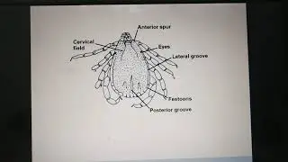Hard ticks part1