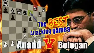 Learn How You Attack from World Chess Champion! Vishy Anand vs Victor Bologan
