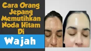 Tips Cara Menghilangkan Flek Hitam Di Wajah Secara Alami & Cepat ! - @RESEP ALAMI