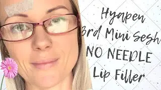 Hyapen 3rd Session!!! NO NEEDLS LIP FILLER!!