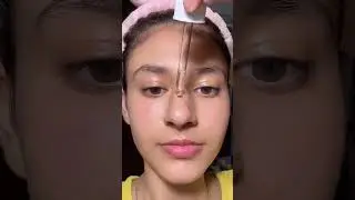 Ordinary salicylic acid routine.🤩🤩