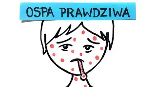Ospa prawdziwa - jak ją pokonaliśmy?