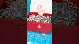 How A Hand Transplant Works ✋ Surgeon Reacts