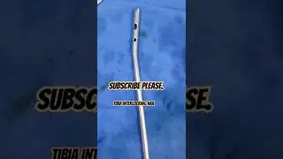 Interlocking Tibia Nail. #dentalequipment #orthopedicsurgeon #viral_video
