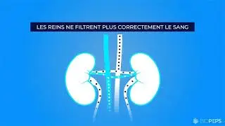 Comprendre la maladie chronique rénale