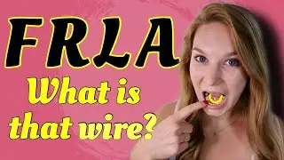 FRLA Dental Appliance | What is it? | Controlled Arch Braces