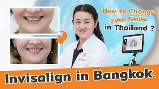 Invisalign in Bangkok, Thailand | Correct crowding with Invisalign | Beyond smile clinic