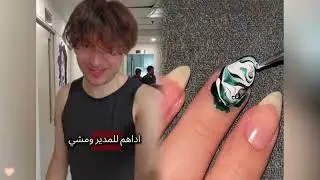 #الطفل الاعمى المعجزه #محضوره_من_الاكسبلور_والمشاهدات #علاوي_مارتن#اكسبلور 15_w🤣👌👌👌