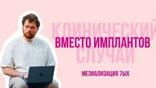 Клинический случай: закрытие промежутков после удаления нижних 6-х (мезиализация, мини-винты)
