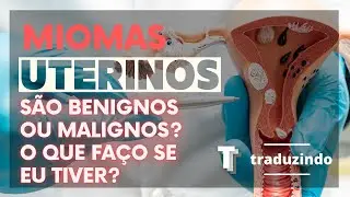 Traduzindo Miomas e Leiomiomas: O que são e como afetam a saúde feminina?