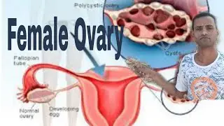 Ovulation in human female ovary, Graafian follicle, corpus luteum