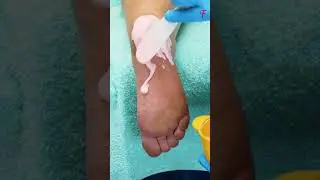 Foot care #shorts
