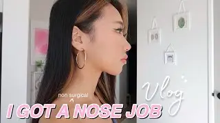 I GOT A NOSE JOB | Nose filler experience, recovery, + Q&A