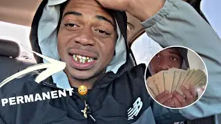 Getting Permanent Gold Teeth At 20! (Cost + Process)