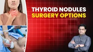 Thyroid Nodules Surgery | Treatments | Surgery Options | Dr. Thalavai Sundarram | Thyroid Nodules