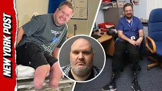 Surgeon accused of LYING about why he had to amputate his own legs after $680,000 insurance claim