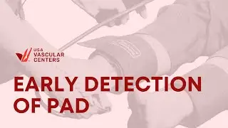 Why is Early Detection and Treatment of PAD so Crucial?