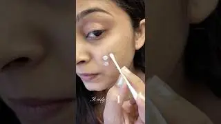 😱 Pimple disappeared overnight?! Pink Foundry Review✅#shorts  #skincare  #acne  #youtubeshorts