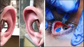 15 Personas Que Se Hicieron Modificaciones Corporales Extremas