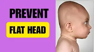 PREVENT FLAT HEAD SYNDROME WITH 5 SIMPLE TIPS AND TRICKS