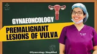 GYNAEONCOLOGY (PREMALIGNANT LESIONS OF VULVA) II DR JYOTI II GYNAECOLOGY SIMPLIFIED