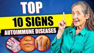 How to Reverse Autoimmune Disease Naturally (Doctors Won&rsquo;t Tell You This) | Barbara O&rsquo;Neill