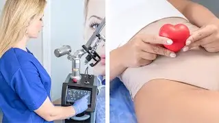 Laser &Kappa;ό&lambda;&pi;&omicron;&upsilon;   #drzografou #vaginallaser