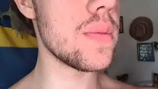 Minoxidil Beard - Week 29 | BLONDE TERMINAL HAIRS!