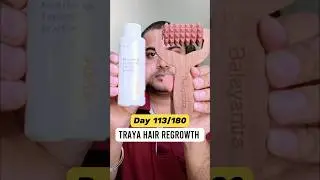 Day 113/180  Traya Minoxidil | Waidon Balayantra | Hair Regrowth