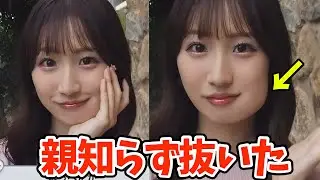 【歯】親知らず抜いたら名前改名しようかと思うぐらい歯が腫れちゃったお天気お姉さん【田辺真南葉】