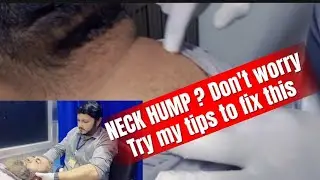 Best Neck Hump Exercises to Correct Posture and Reduce Dowager&rsquo;s Hump Naturally #neckhump #neckpain