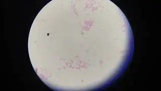 Blood C/S subculture gram staining view