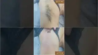 Before & After WAXING Result at Grace Threading
