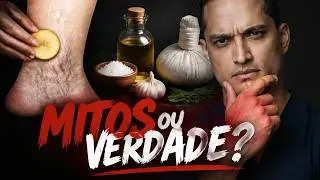 Solu&ccedil;&otilde;es caseiras funcionam para tratar varizes?