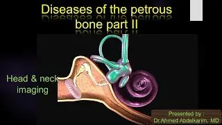 6-pathology of the petrous bone II