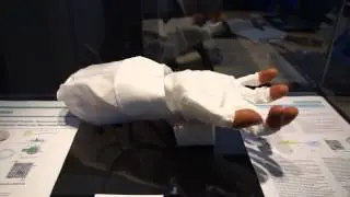 CeBIT 2013: Hightech-Hand Prosthesis