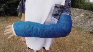 Crash fail vtt chute plâtre GOPRO
