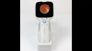 Portable (handheld )fundus camera(retinal camera ) FC-100 electronic user manual .